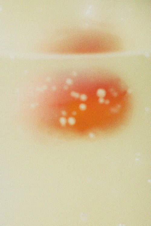 The Benefits of Choosing Lip Balm with Lanolin for Dry Lips