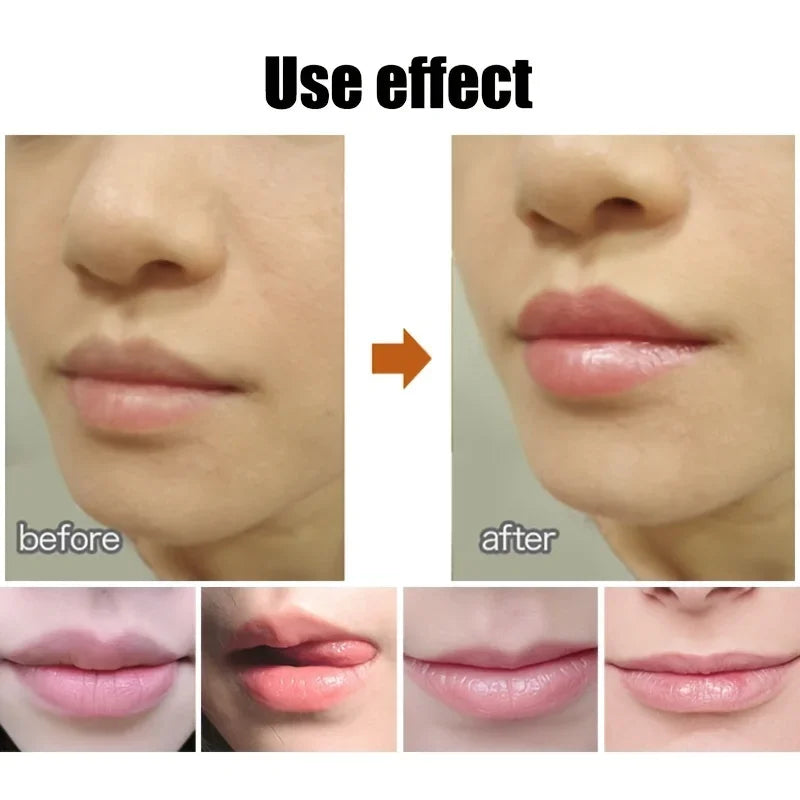 Lip Balm Ball - LIPOXI