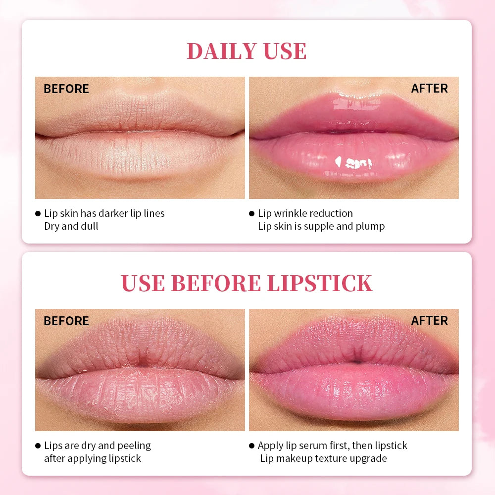Pink Lip Serum Lotion Moisturizes And Plump Lips - LIPOXI