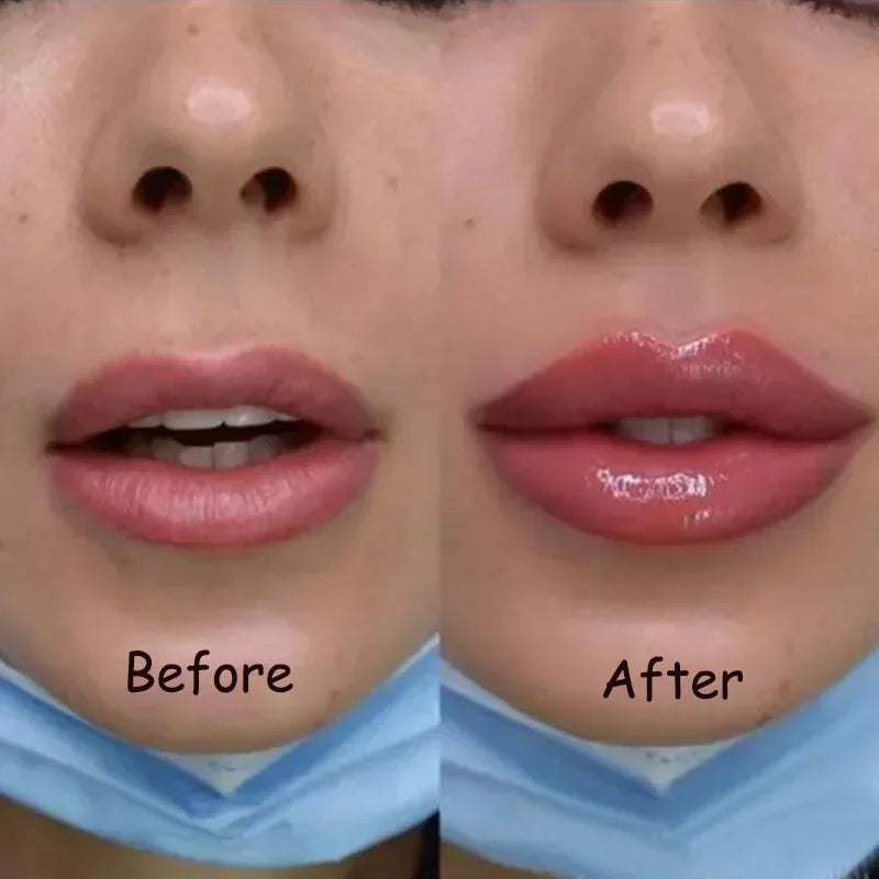 Revitalizing Lip Plumper Oil - LIPOXI