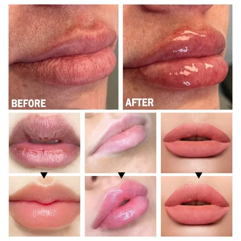 Revitalizing Lip Plumper Oil - LIPOXI