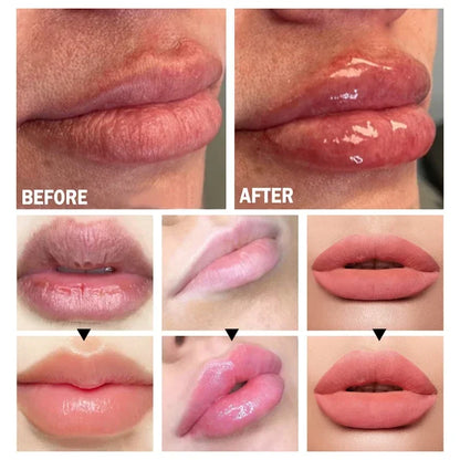 Revitalizing Lip Plumper Oil - LIPOXI