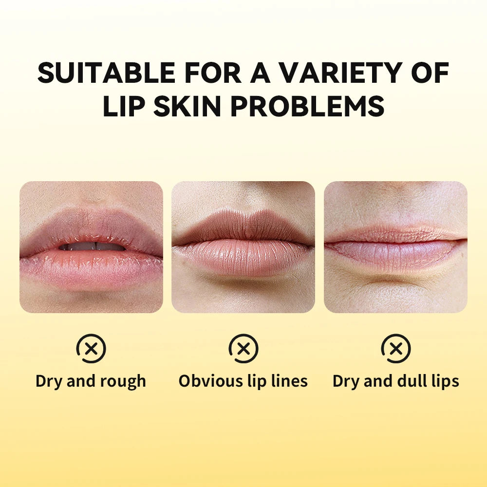 Propolis Honey Lip Gel - LIPOXI