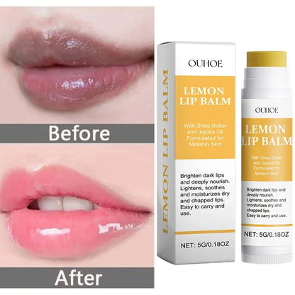 Turmeric Lip Balm for Dark Lips - LIPOXI