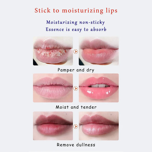 Radiant Lip Care Balm: - LIPOXI