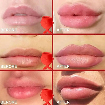 Painless Silicone Lip Plumper - LIPOXI