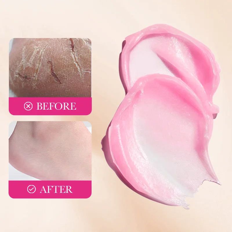 Foot Cream for Cracked Heels - LIPOXI