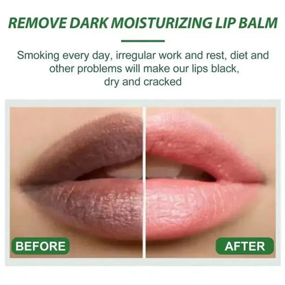 Turmeric Lip Balm for Dark Lips - LIPOXI