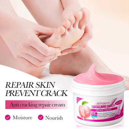 Foot Cream for Cracked Heels - LIPOXI