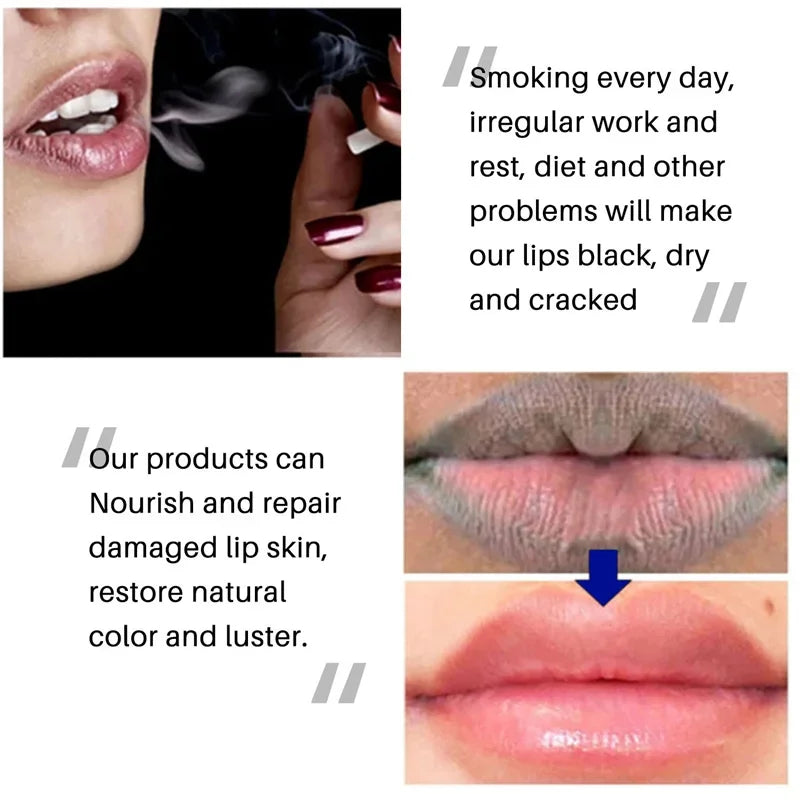 Revitalize Your Lips: Dark Lip Treatment Balm - LIPOXI