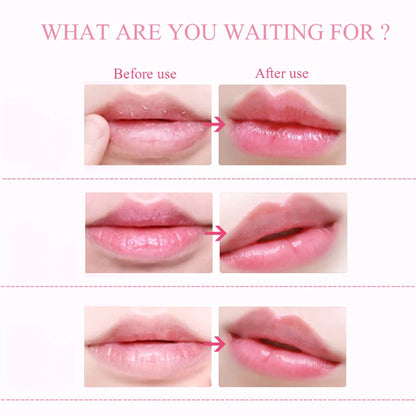 20pcs Collagen Moisturizing Lip Masks - LIPOXI