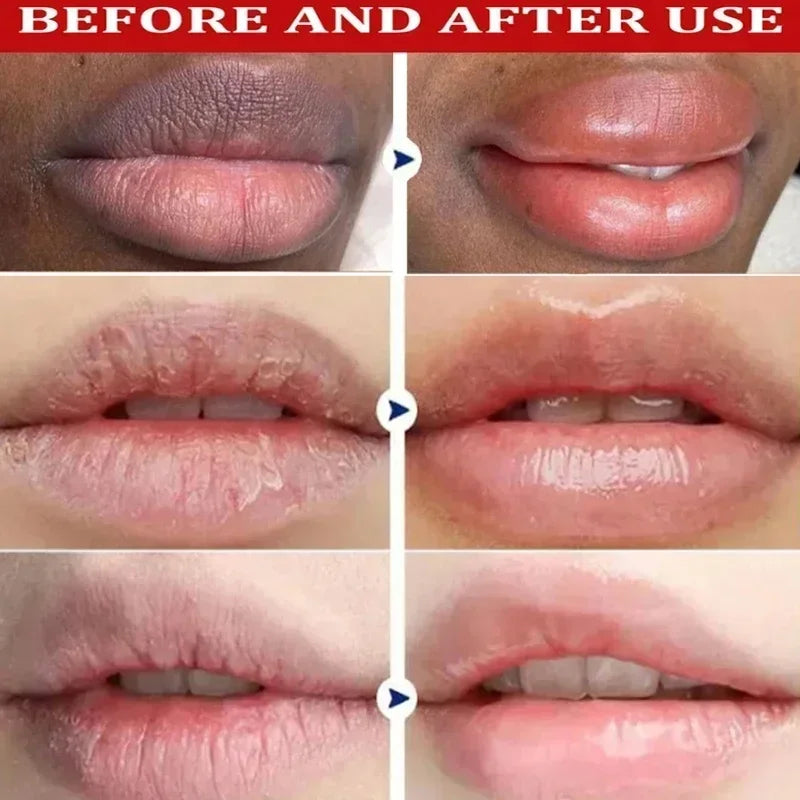 Revitalizing Lip Balm for Brightening Lips - LIPOXI