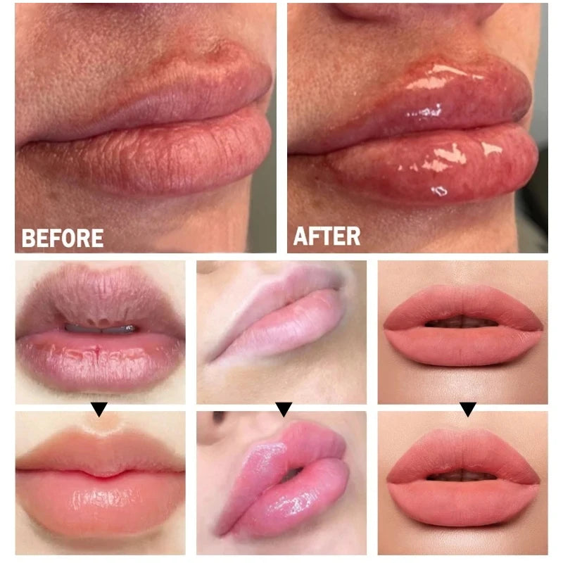 Lip Plump Serum Increase Lips Elasticity And Nourish Care - LIPOXI