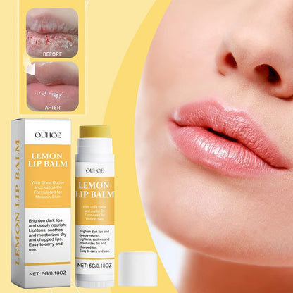 Turmeric Lip Balm for Dark Lips - LIPOXI