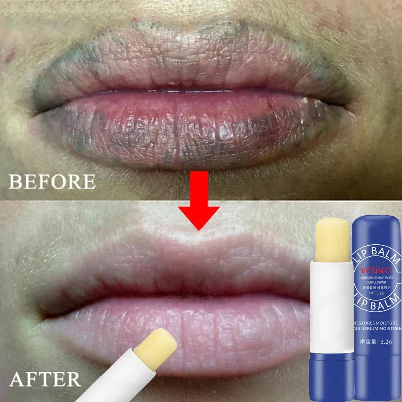 Revive & Brighten Lip Balm - LIPOXI