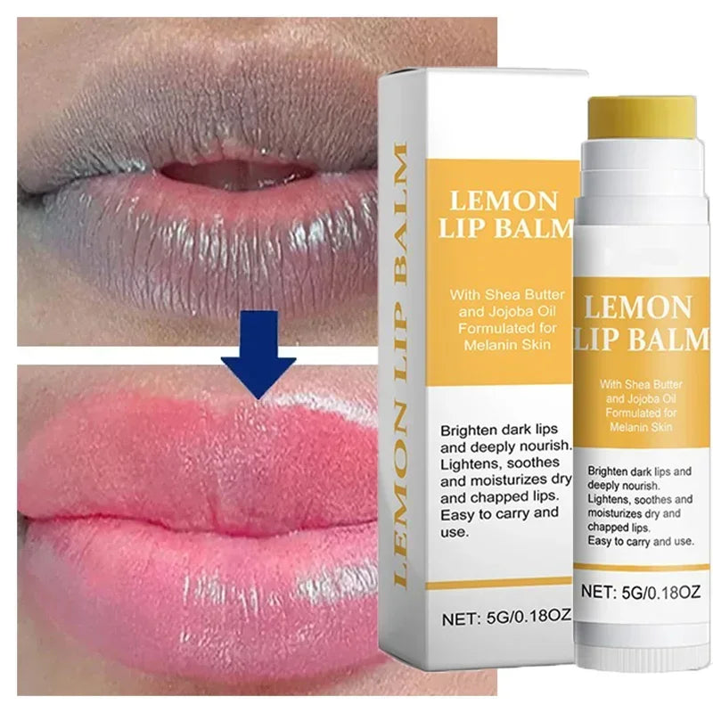 Lemon Ginger Lip Bliss - LIPOXI