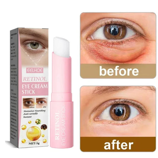 Revitalizing Retinol Eye Cream - LIPOXI