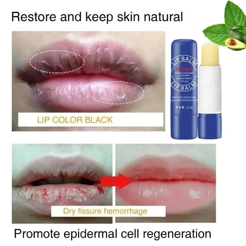 Lip Balm Whitening Remove Dark Lighten Melanin Repair Care - LIPOXI