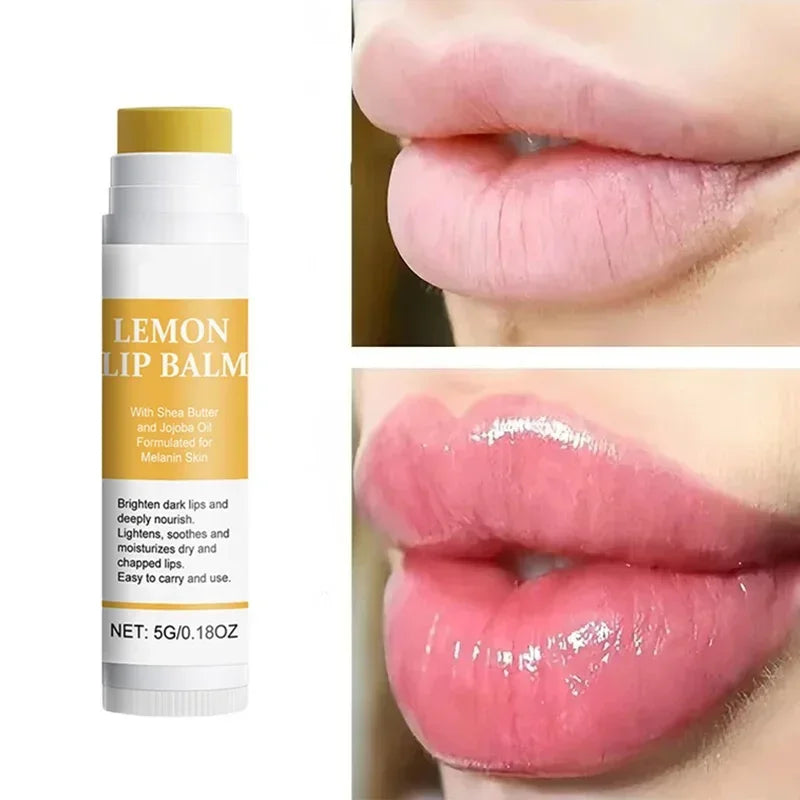 Lemon Ginger Lip Bliss - LIPOXI