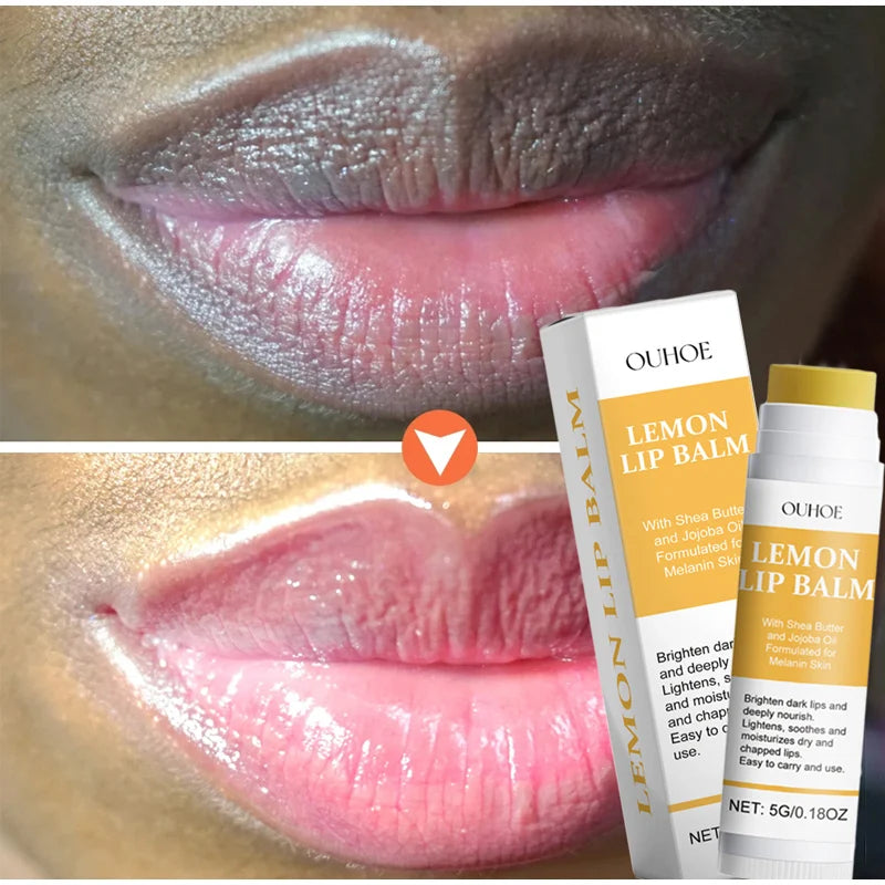 New Remove Dark Lip Balm Lightening Melanin Mask Gloss - LIPOXI