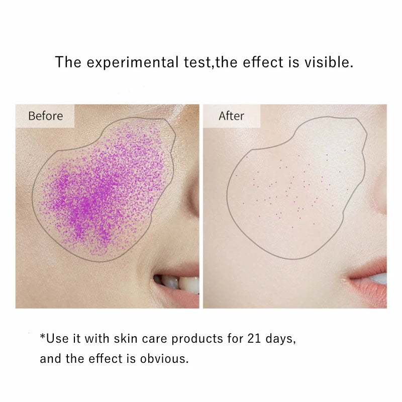 Ultra-Thin Disposable Masks - LIPOXI