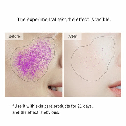 Ultra-Thin Disposable Masks - LIPOXI